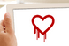 Heartbleed - web services